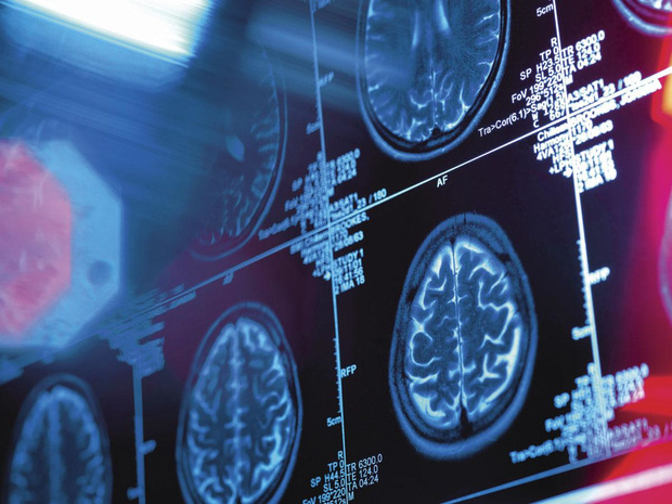 Negen healthTech trends om naar uit te kijken