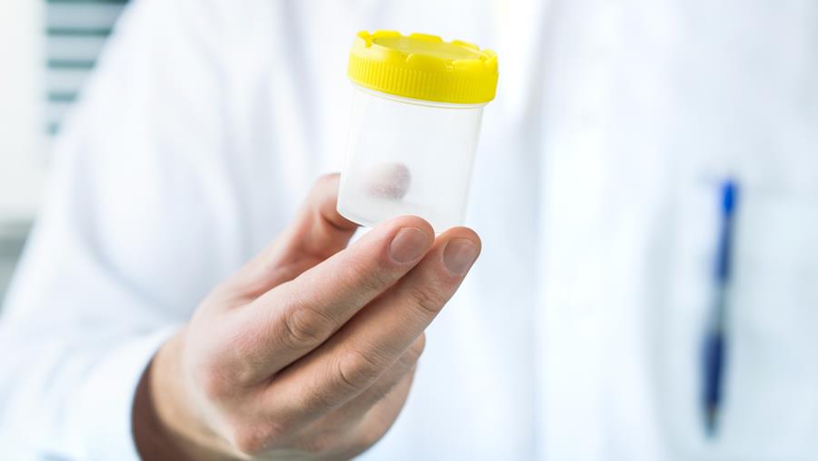 200 enfants conçus avec le sperme potentiellement cancérigène, Vandenbroucke plaide pour un registre européen